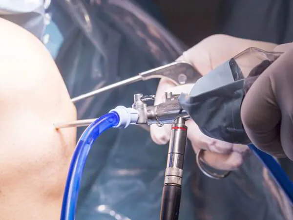 Minimally Invasive Knee Joint Replacement Dr. Pradyumna