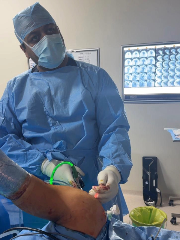 Frozen shoulder treatment in Bangalore