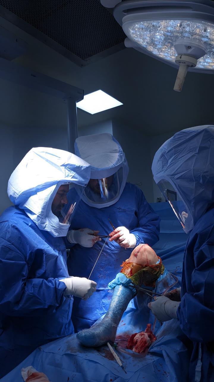 Orthopaedic knee fracture surgery in progress in the operating theatre